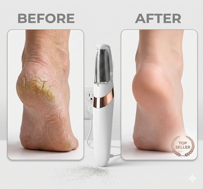 Electric Foot Callus Remover